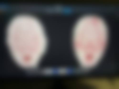 患者真实评价：魏晓丹医生口碑见证