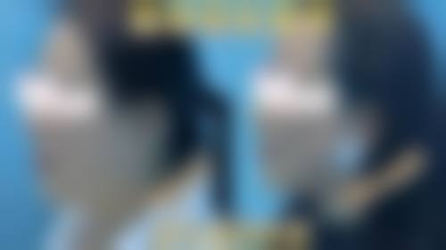 结语:选择晶美,开启自信美丽新篇章