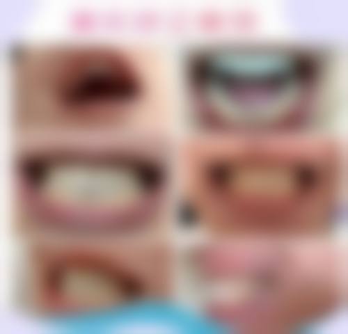 预约优惠活动深圳维港口腔汪艳玲