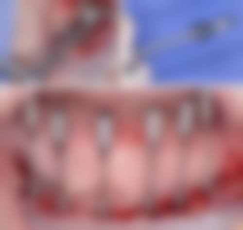 预约优惠活动:北京嘉和口腔门诊部秦道君