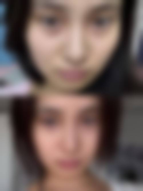 透明收费体系解析,高性价比助力美丽升级