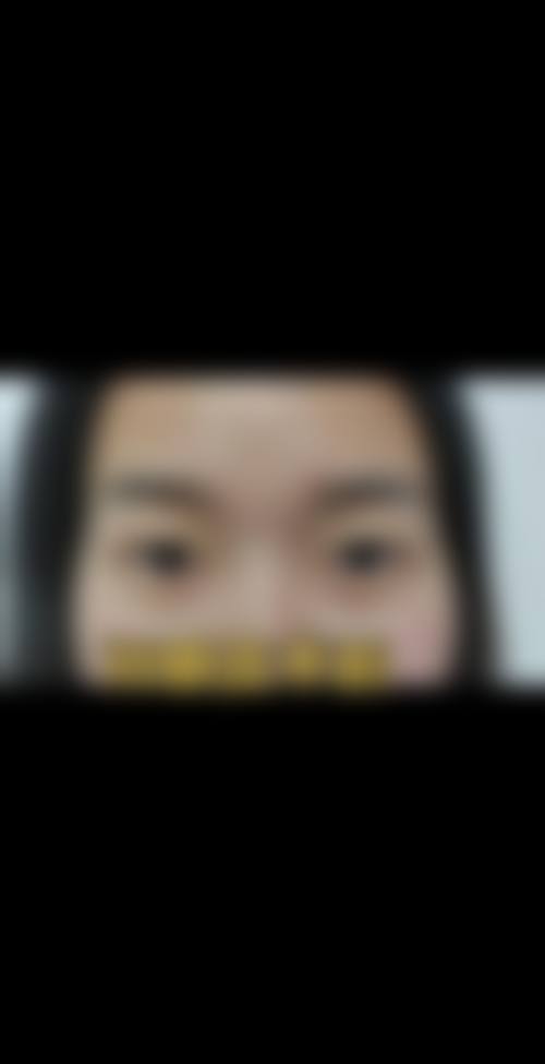 结尾预约号召：立即行动守护眼健康
