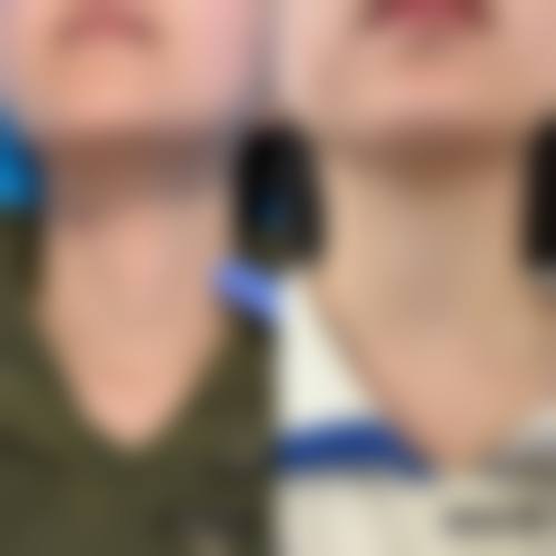 常见问题解答