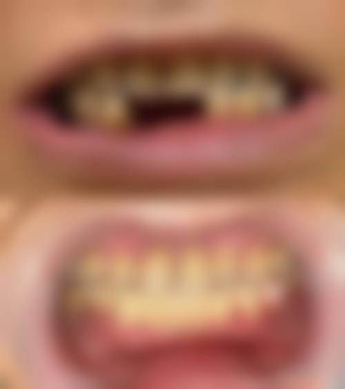 价格透明与优惠活动