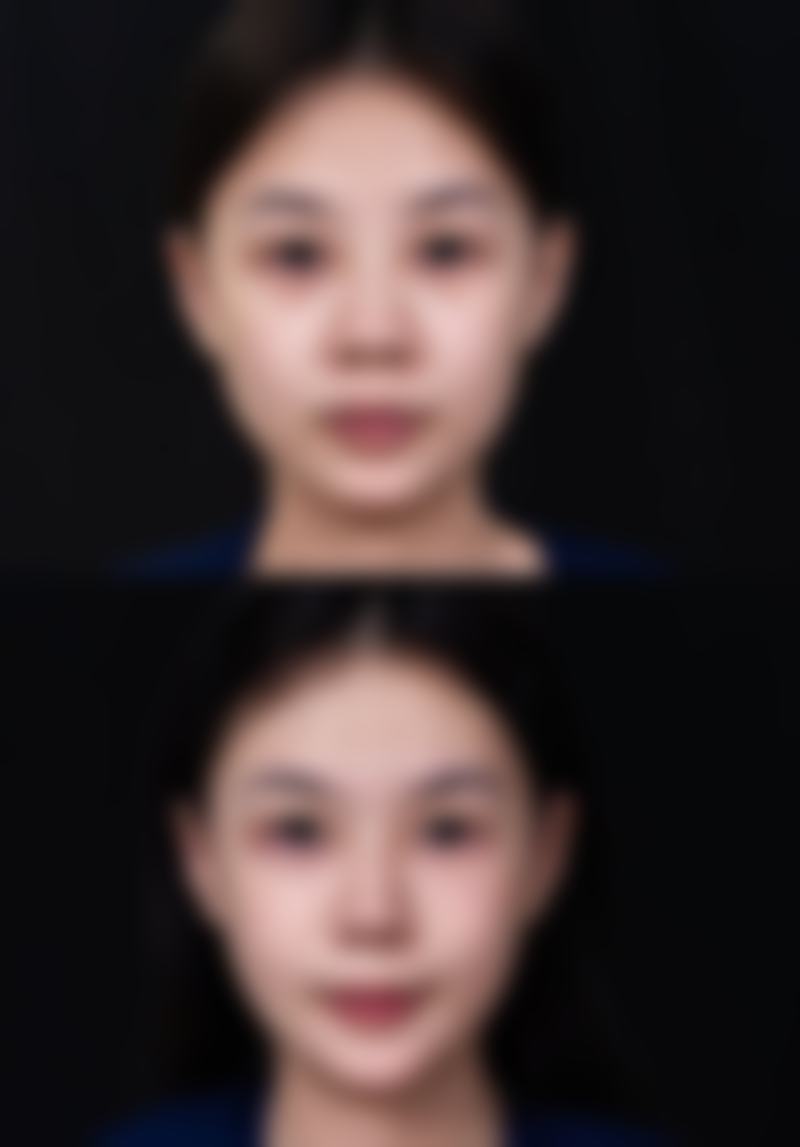 优惠活动详情与价格透明化