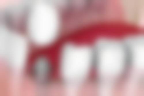 患者真实评价重庆存济口腔医院鲁珂珂
