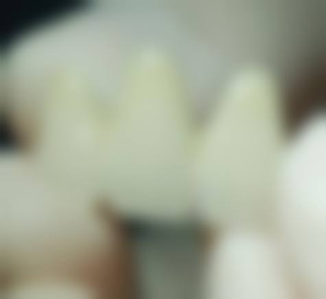 结尾预约号召重庆存济口腔医院鲁珂珂