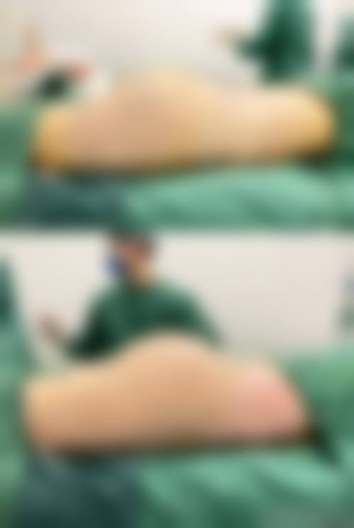 诊疗特色总结尚绍辉医生