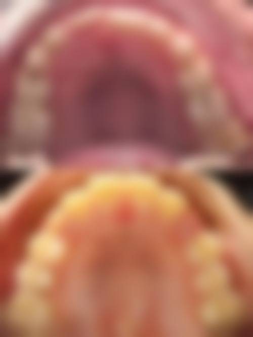预约优惠活动