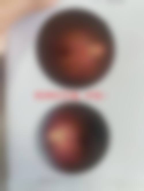 临床实例分享