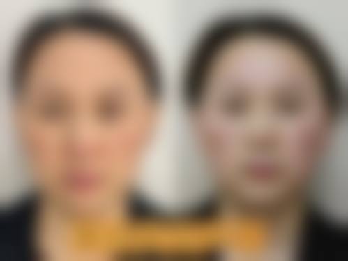 医生资质介绍深圳华医医疗美容门诊部王宗坤