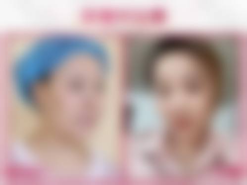 服务流程与FAQ:无忧变得更美,全程陪伴
