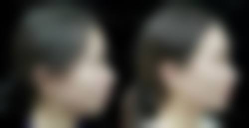 擅长项目详解深圳华医医疗美容门诊部王宗坤