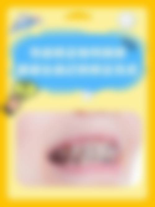 预约优惠活动