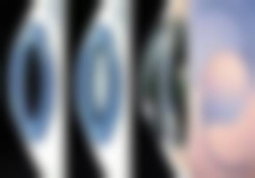 ICL手术优势解析:微创、可逆、视觉质量高