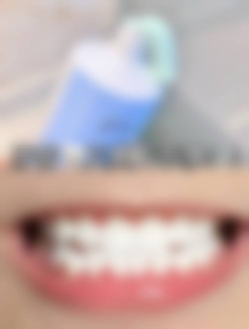 临床实例分享