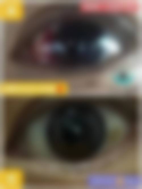 预约优惠活动：现在预约有什么补贴？