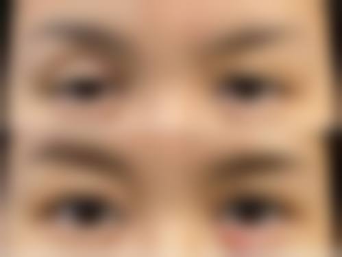 医生资质介绍：重庆医 科 大学附属第二医院眼科李兰娇的专精背书