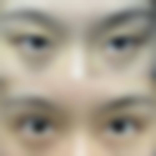 FAQ：关于重庆医 科 大学附属第二医院眼科李兰娇的常见疑问