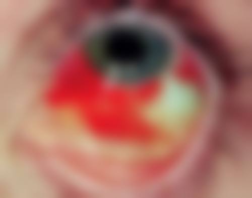预约优惠活动：重庆医 科 大学附属第二医院眼科李兰娇的专属补贴