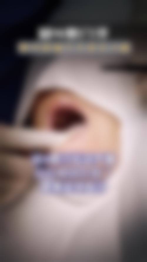 预约优惠活动:限时补贴不容错过