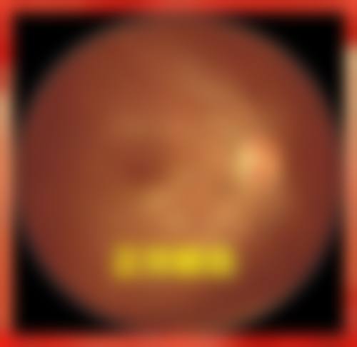 结语:守护眼部健康,从这里开始
