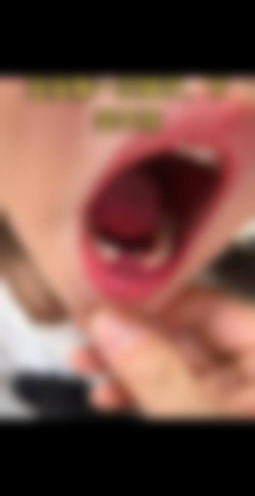 临床实例分享
