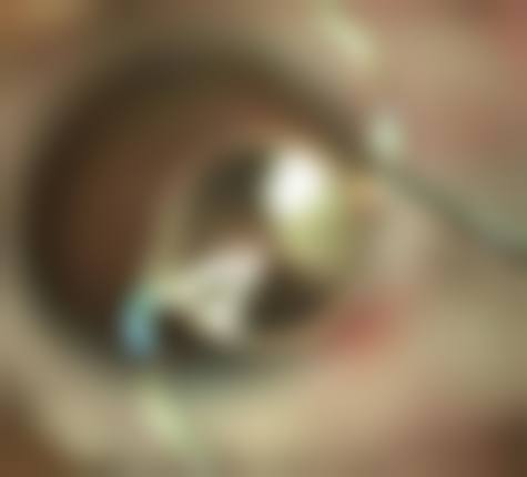 预约优惠活动:限时补贴助力就医