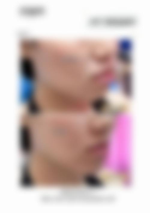 常见问题解答